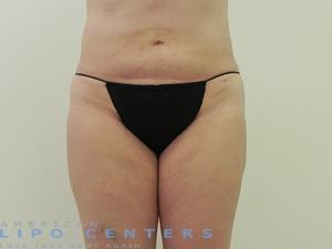 americanlipocenters_46.jpg